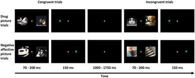 Modulation of Attentional Bias to Drug and Affective Cues by Therapeutic and Neuropsychological Factors in Patients With Opioid Use Disorder on Methadone Maintenance Therapy